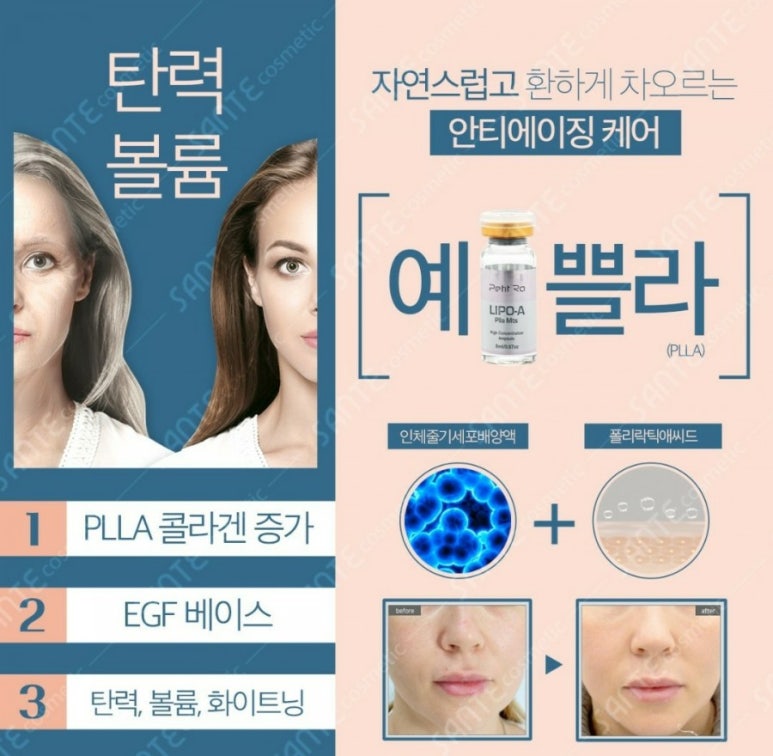 샤테라피 이미지