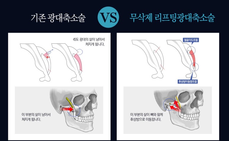 페이스성형외과의원 이미지