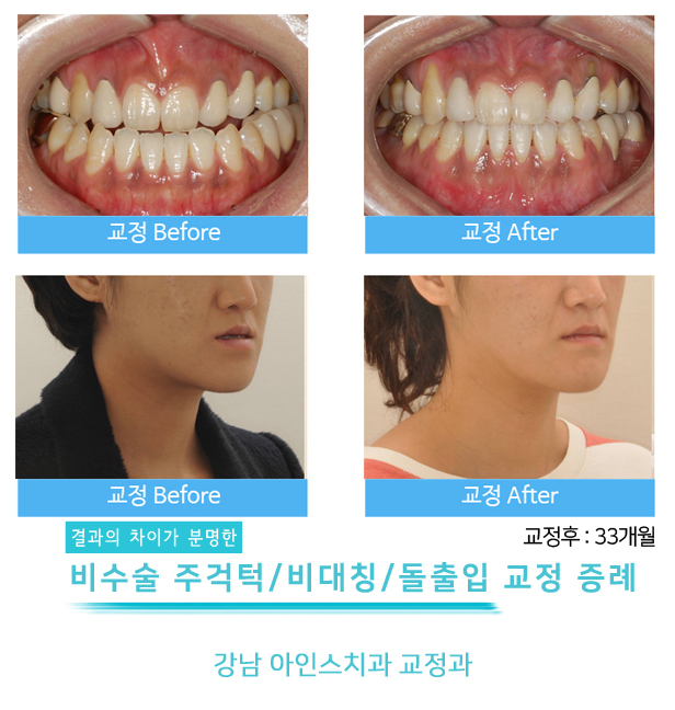 아인스치과의원 이미지
