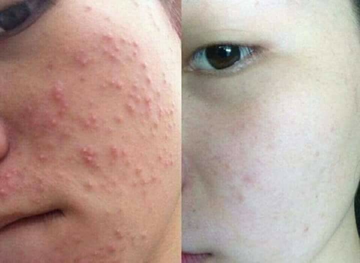 스마일뷰티 이미지