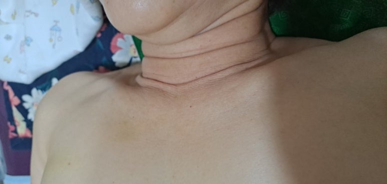 썬체형관리 이미지