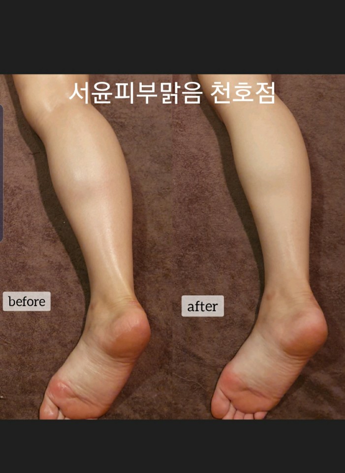 피부,맑음 이미지