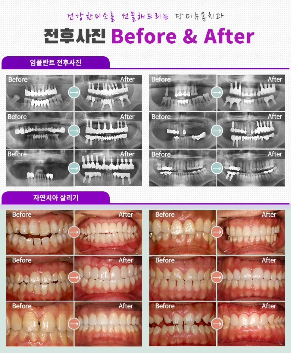 성락치과 이미지