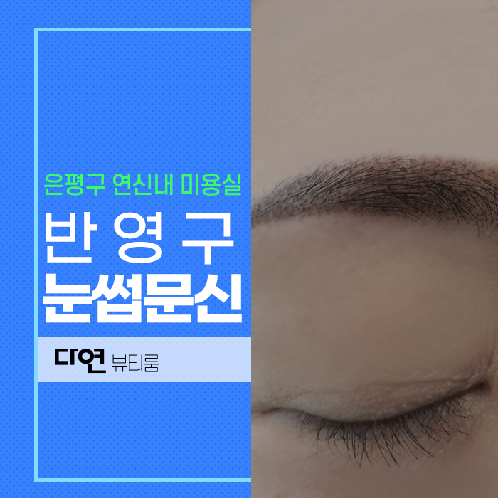 다연헤어라인 이미지
