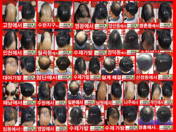 일신가발 이미지