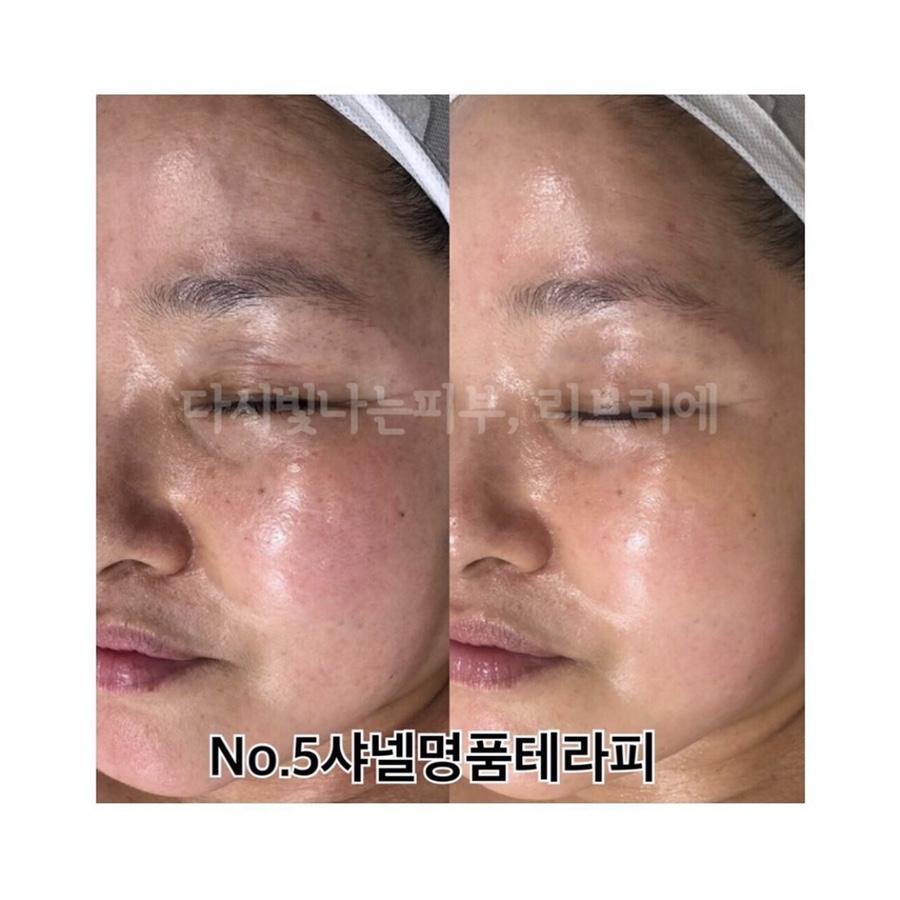 샤테라피 이미지