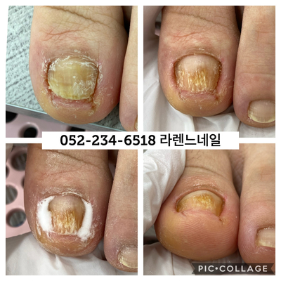 라렌느네일 이미지
