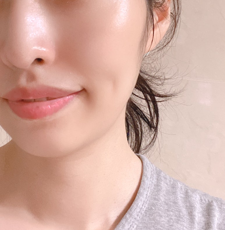 셀메딕스 이미지