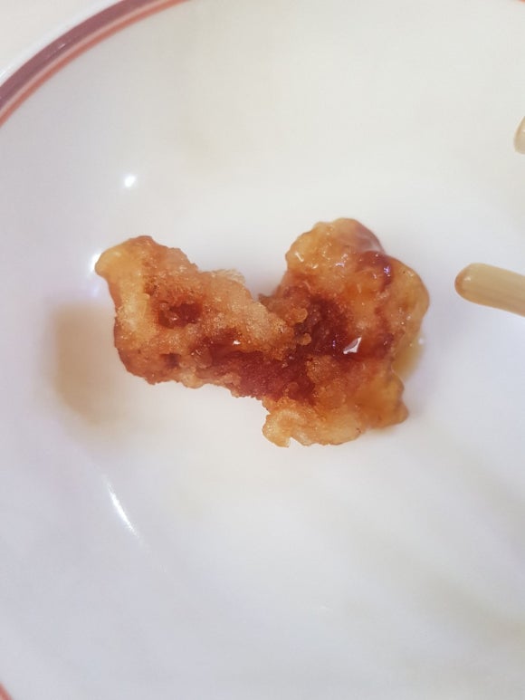 미광반점 이미지