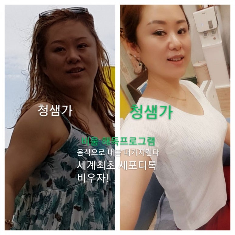 청체형관리 이미지