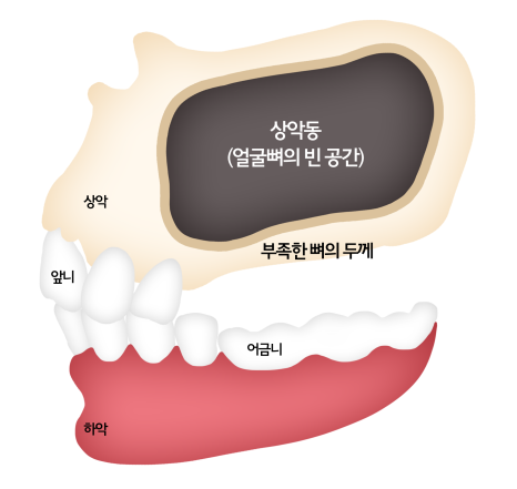 효치과 이미지