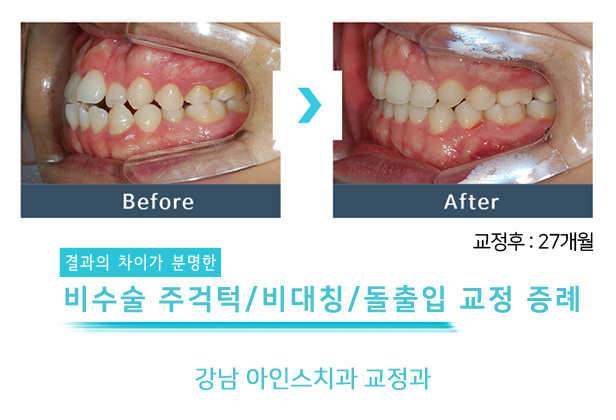 아인스치과의원 이미지