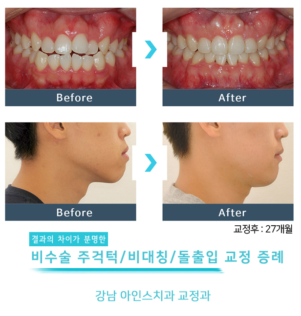 아인스치과의원 이미지