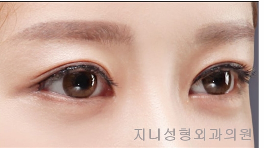 지니성형외과의원 이미지