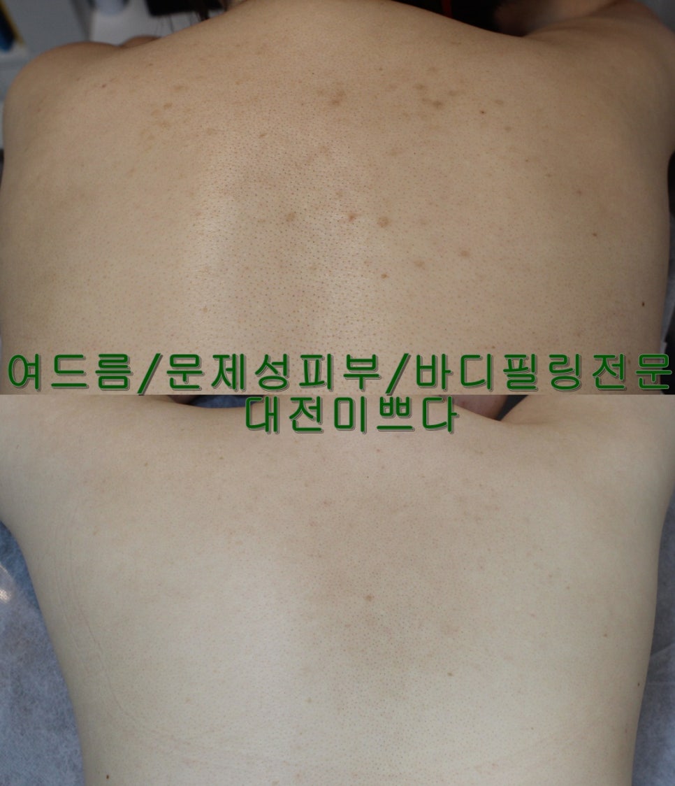미쁘다피부관리 이미지