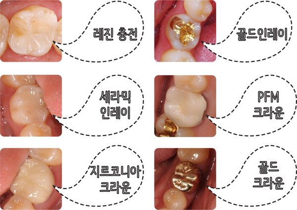 서울굿모닝치과 이미지