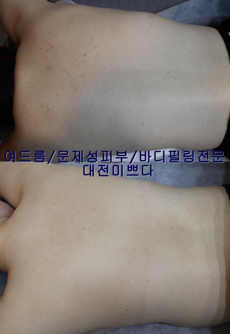 미쁘다피부관리 이미지