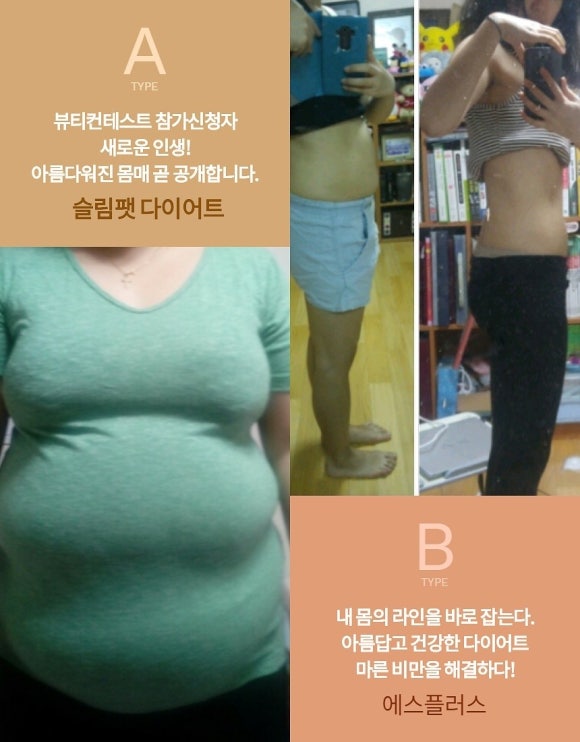 에스플러스 이미지