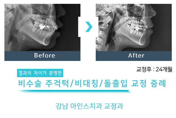 아인스치과의원 이미지