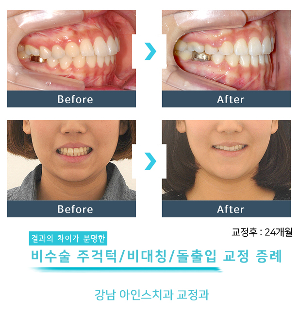 아인스치과의원 이미지