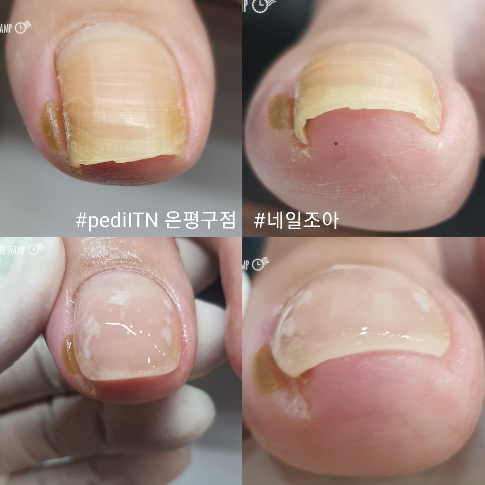 네일조아 이미지