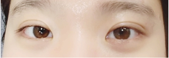 눈썹쟁이 이미지