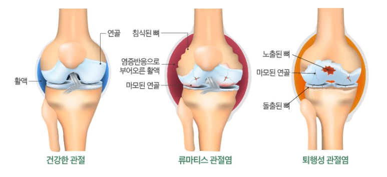 섹칼슘 이미지