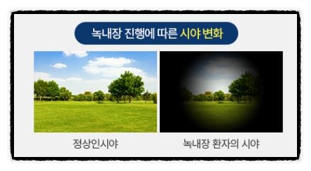 명안과 이미지
