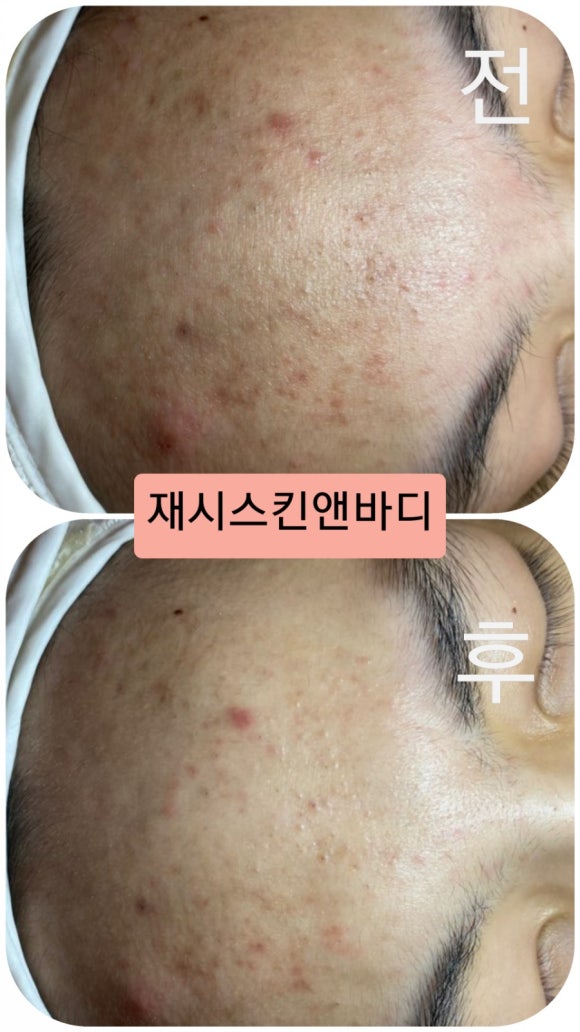 제노필 이미지