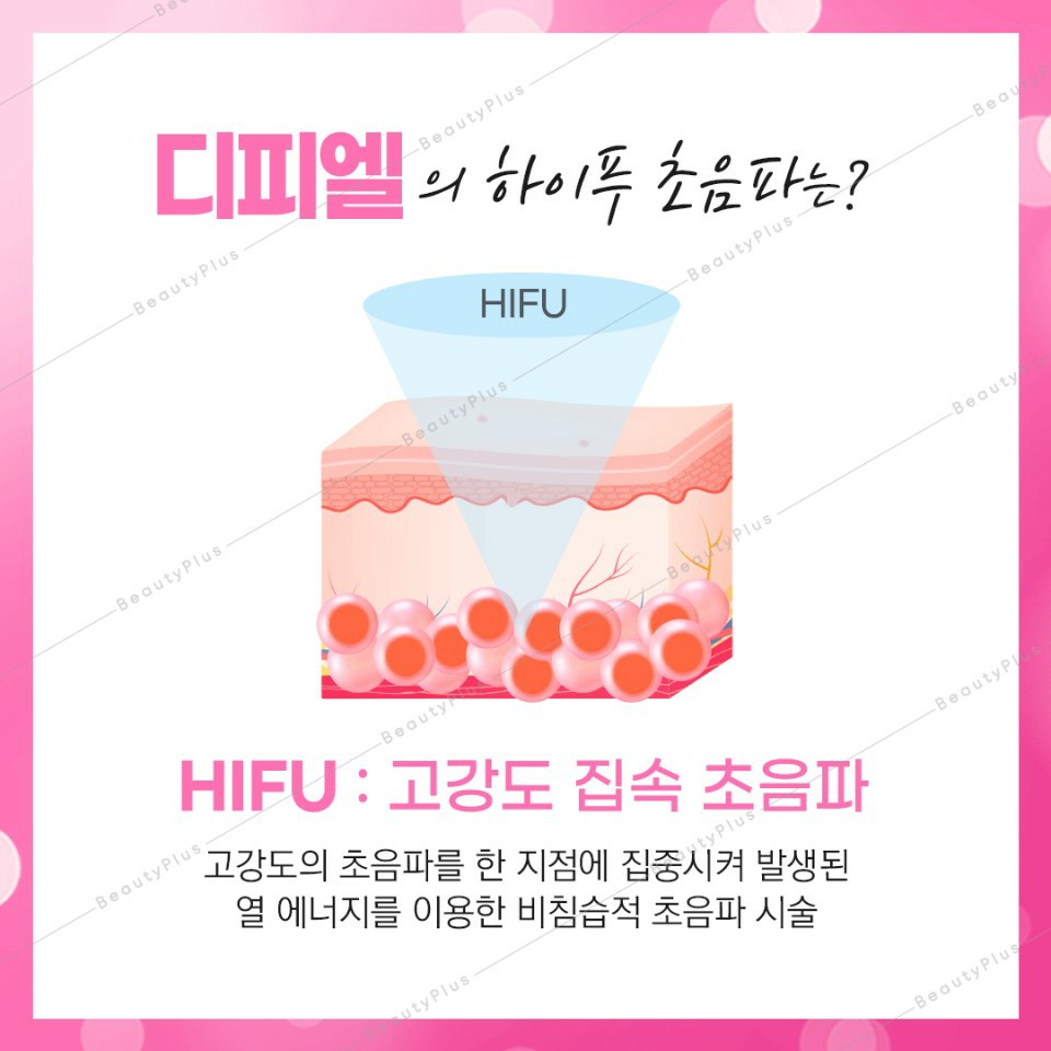 디피엘 이미지