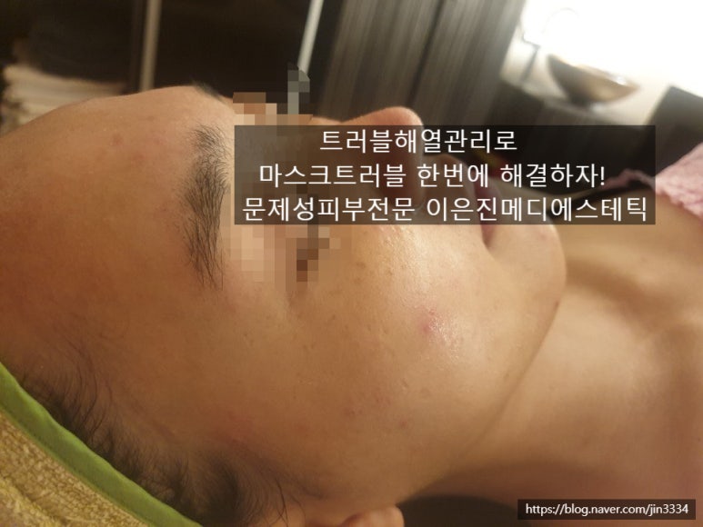 홉 에스테틱 이미지