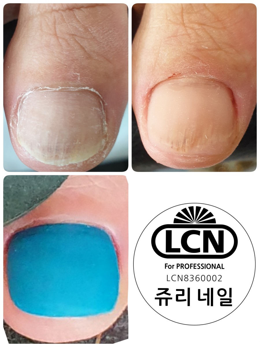 쥬리네일 이미지