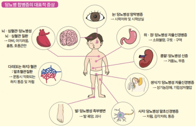 버터숲 이미지