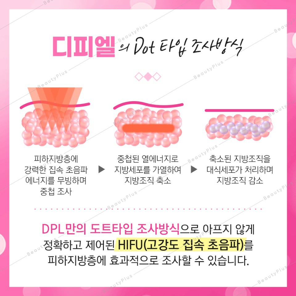 디피엘 이미지