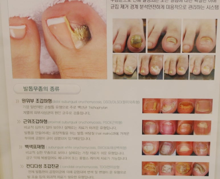 손토비발토비 이미지