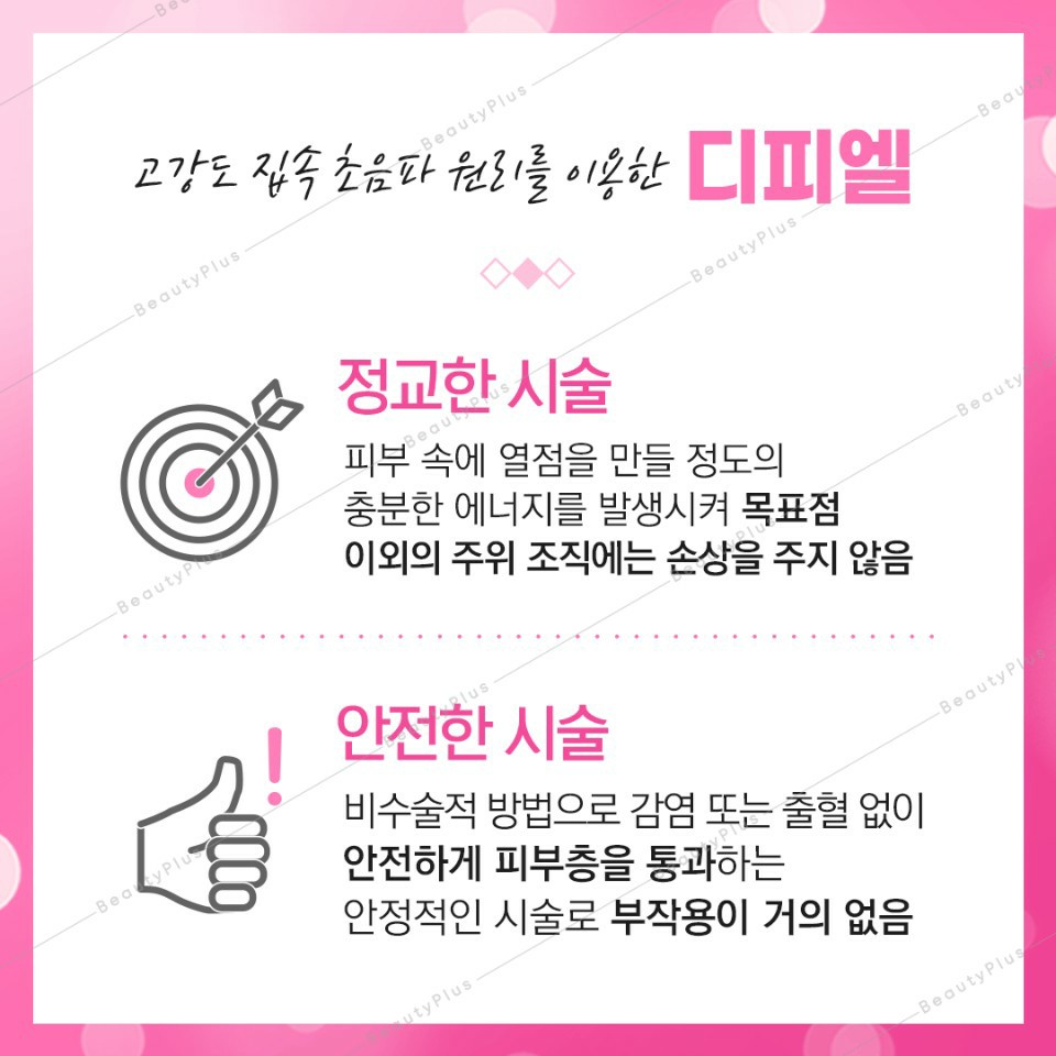 디피엘 이미지