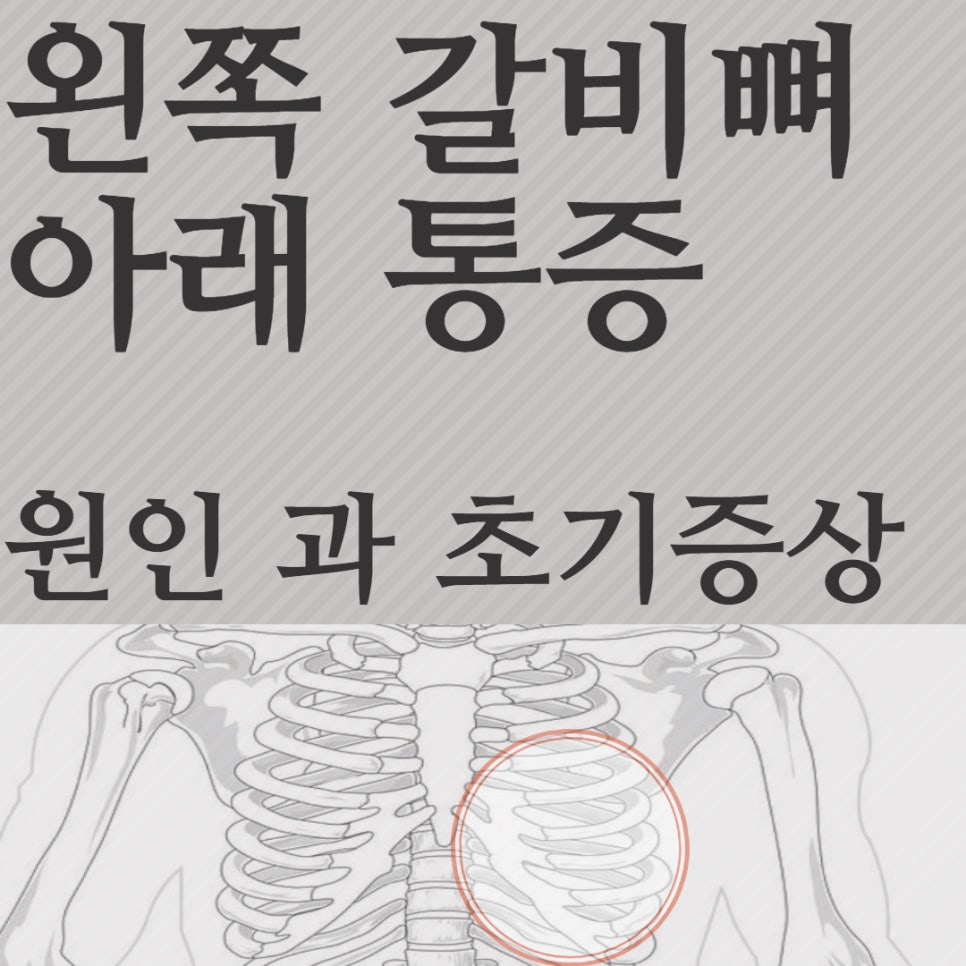 왼쪽 갈비뼈 아래 통증 원인 및 초기증상 네이버 블로그