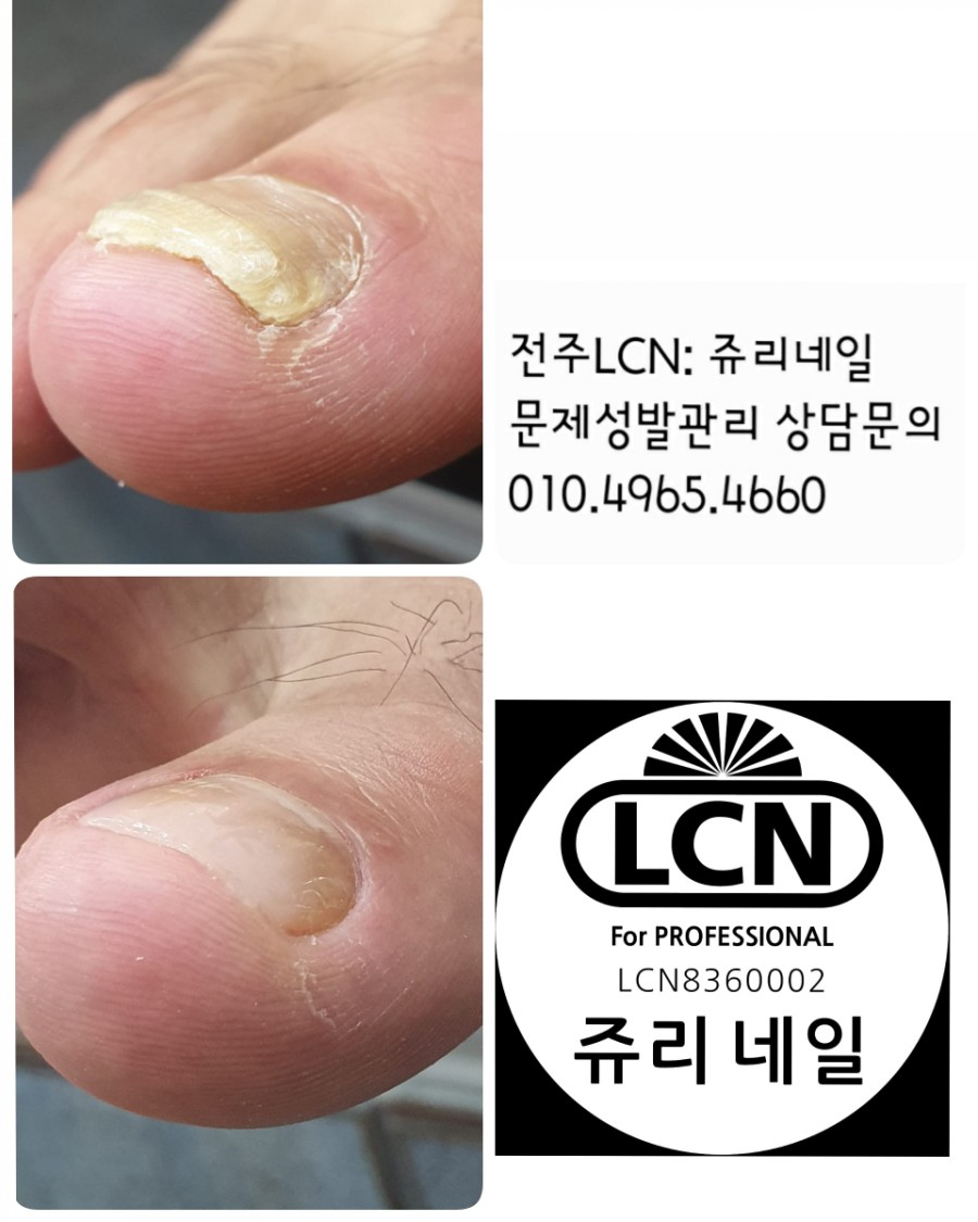 쥬리네일 이미지