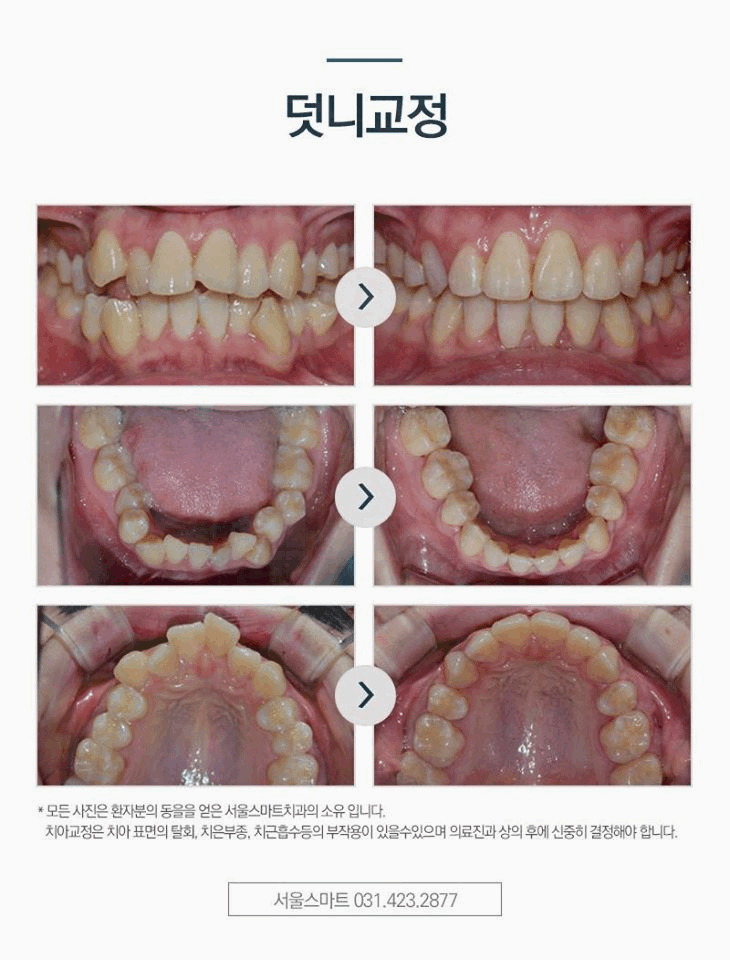 서울스마트치과의원 이미지