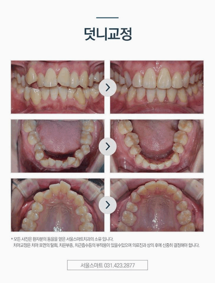 한번에치과의원 이미지