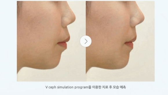 연세고운미소치과의원 이미지