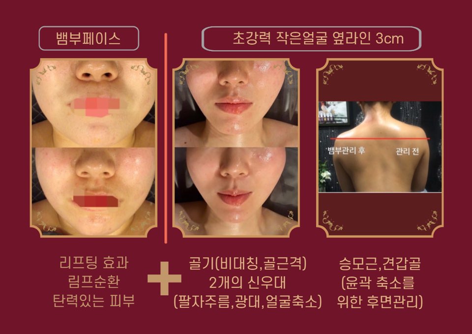 황금마사지 피부관리 이미지