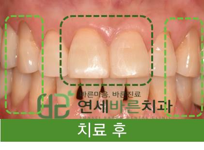 연세바른치과 이미지