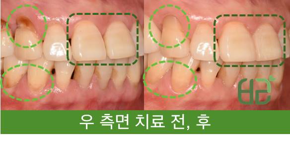 연세바른치과 이미지