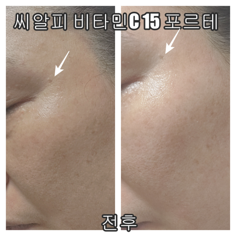 팜스틱 이미지