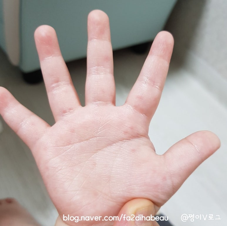 어머나!손칼국수 이미지