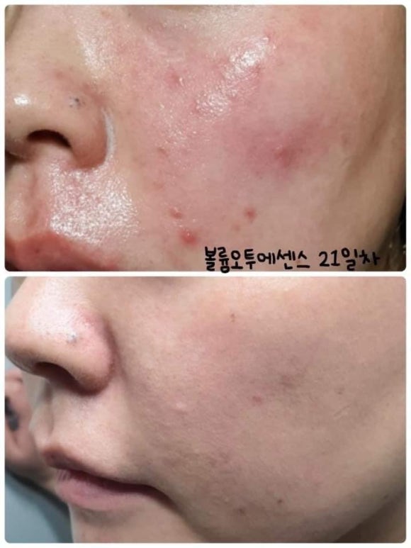 이오스타 이미지