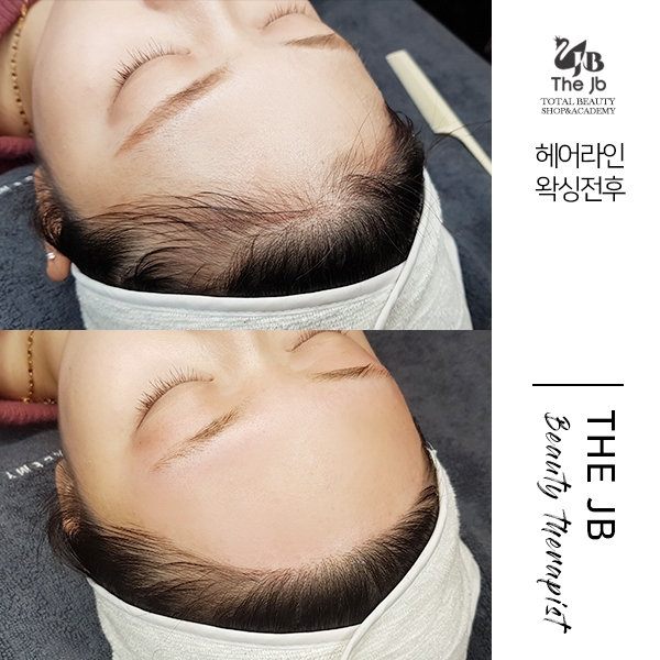 제이비라인 이미지