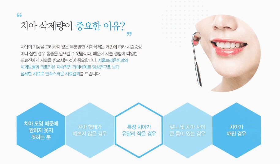 서울브라운치과 이미지