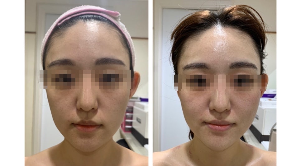 브이라인샵 이미지